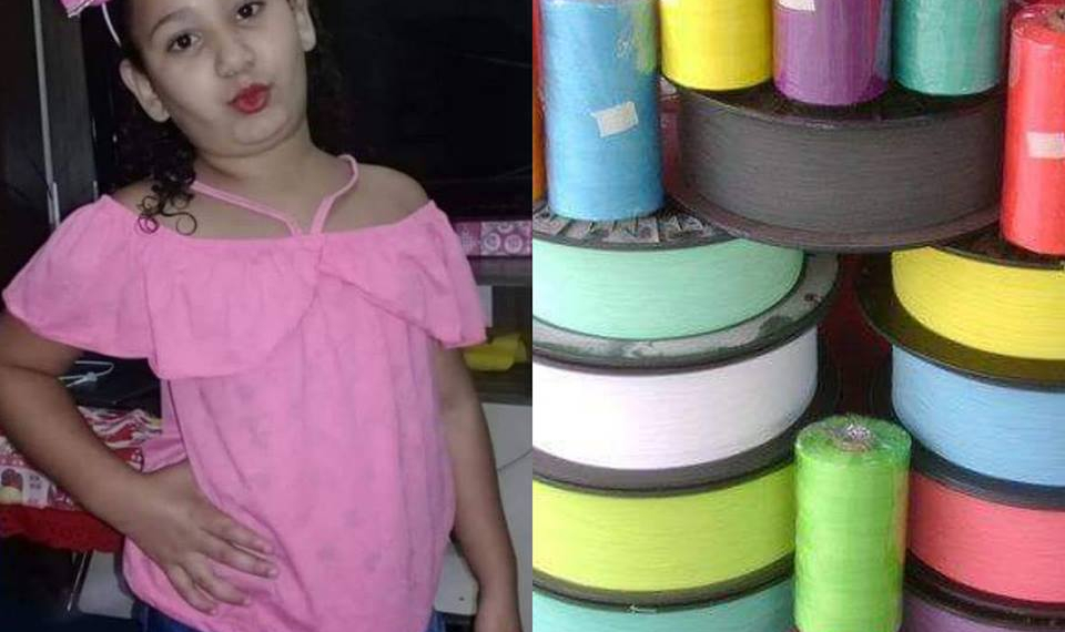 MENINA CORTADA POR LINHA CHILENA EM REALENGO AINDA CORRE RISCO DE PERDER A PERNA