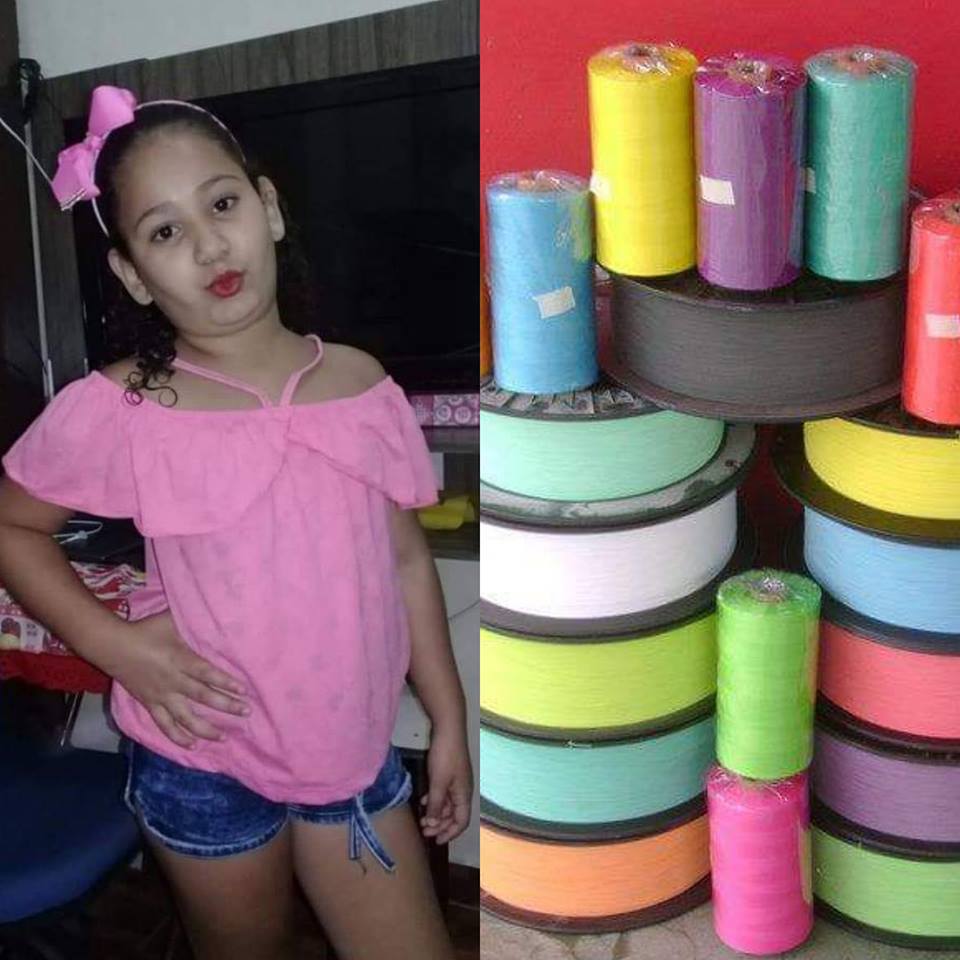 MENINA CORTADA POR LINHA CHILENA EM REALENGO AINDA CORRE RISCO DE PERDER A PERNA