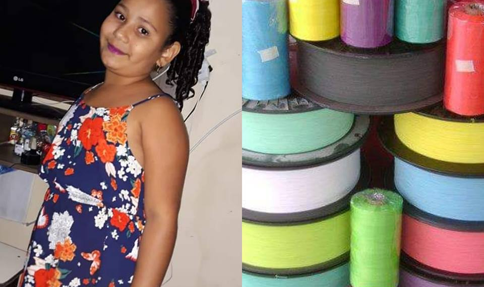 TRISTE NOTICIA!! MENINA VÍTIMA DA LINHA CHILENA EM REALENGO TEM A PERNA AMPUTADA