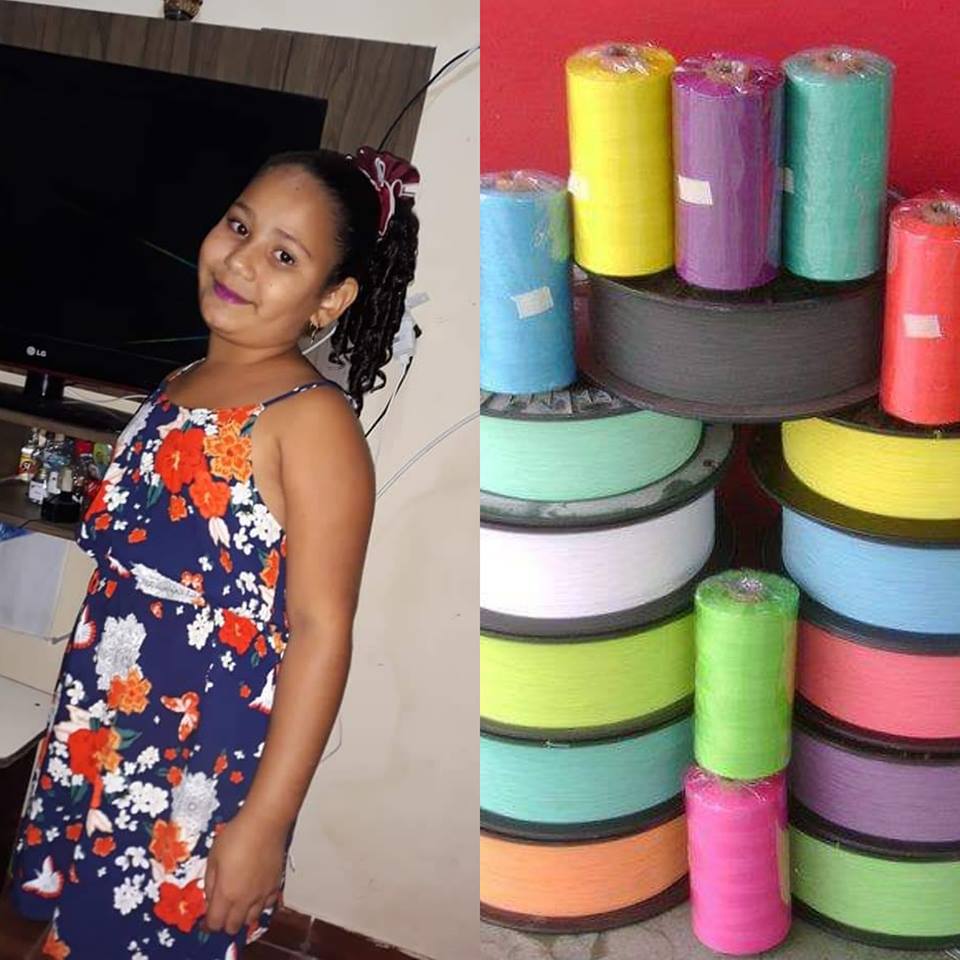 TRISTE NOTICIA!! MENINA VÍTIMA DA LINHA CHILENA EM REALENGO TEM A PERNA AMPUTADA