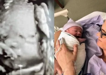 Mãe se recusa a abortar bebê com anomalia e filho nasce perfeito