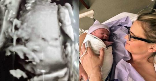 Mãe se recusa a abortar bebê com anomalia e filho nasce perfeito