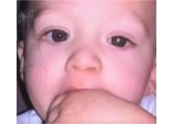 Mãe descobre câncer raro no filho por causa de uma foto