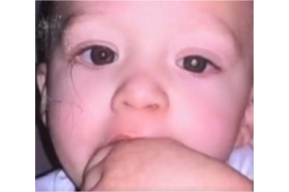 Mãe descobre câncer raro no filho por causa de uma foto