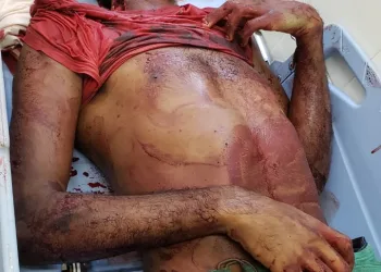 Traficantes são mortos na Zona Oeste ( imagens fortes)