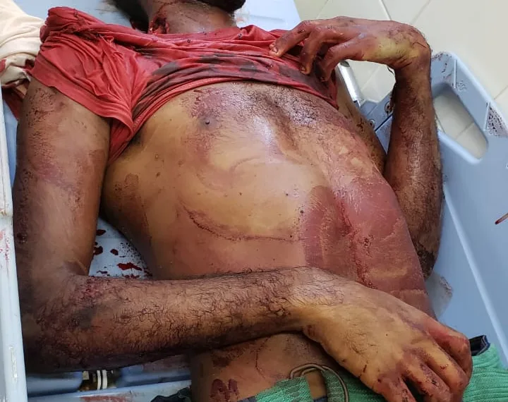 Traficantes são mortos na Zona Oeste ( imagens fortes)