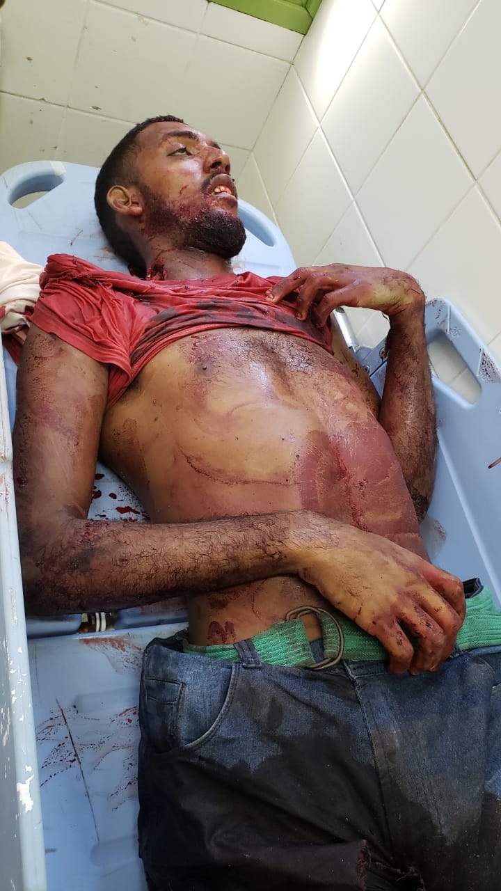 Traficantes são mortos na Zona Oeste ( imagens fortes)