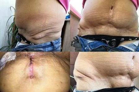 Doutora Frankstein é presa por praticar cirurgias plásticas sem ser médica