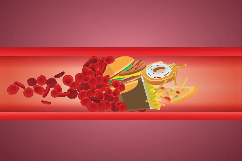 Saiba quais são as diferenças entre o colesterol bom e o ruim