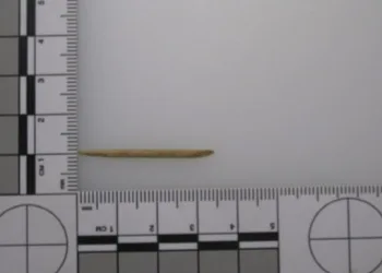 Mulher morre após palito de dente ficar preso na garganta