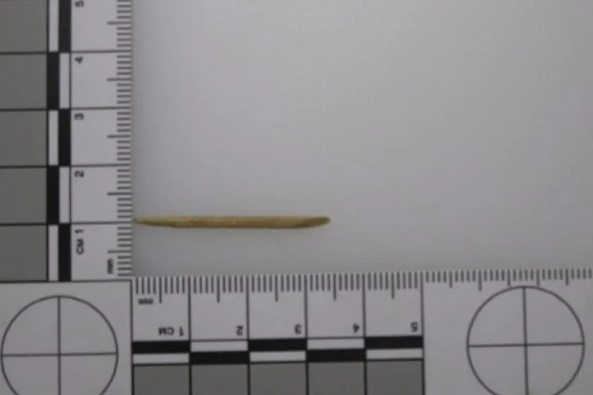 Mulher morre após palito de dente ficar preso na garganta