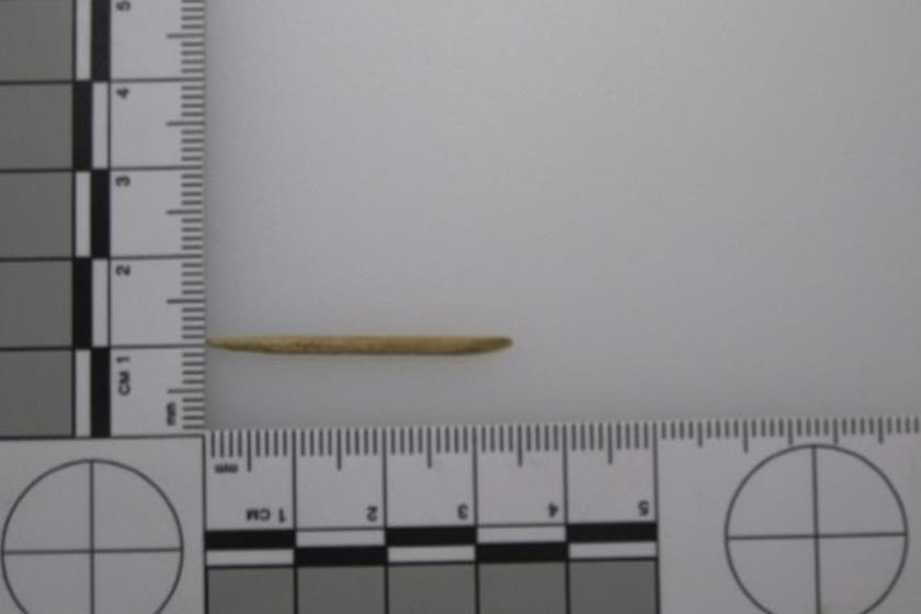 Mulher morre após palito de dente ficar preso na garganta