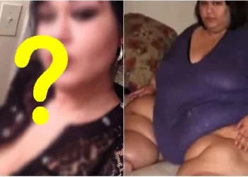 A mulher mais pesada do mundo perdeu 400kg e está irreconhecível, veja como ela está atualmente !