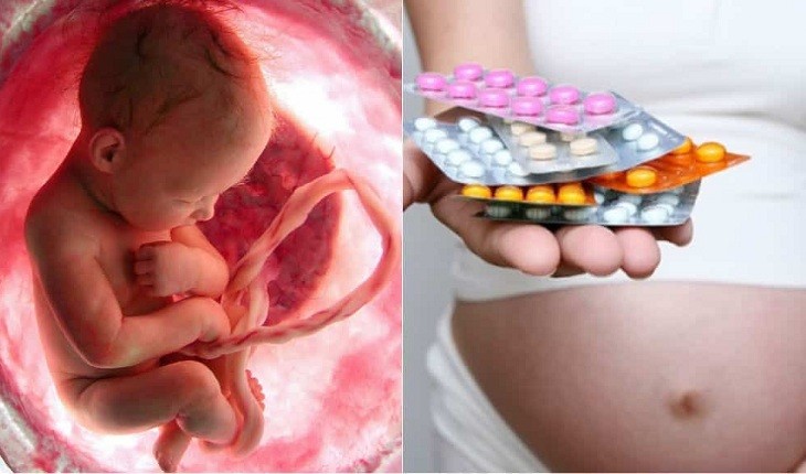 Alerta! Remédio muito usado na gestação pode causar autismo, asma e hiperatividade no bebê