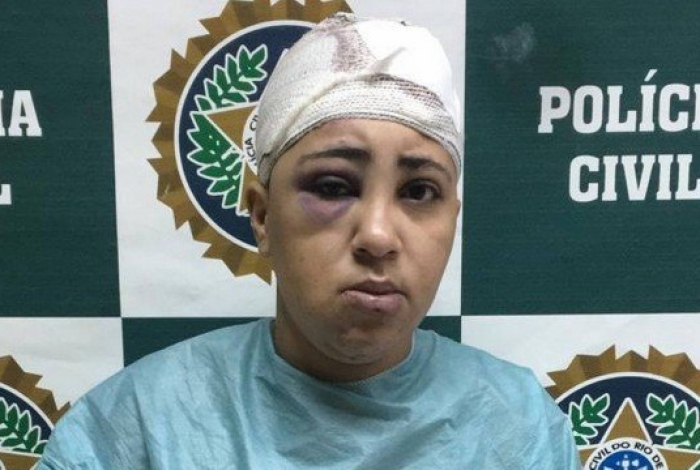 Dessa vez não deu 22! Bandida é desarmada e toma tiro de passageira