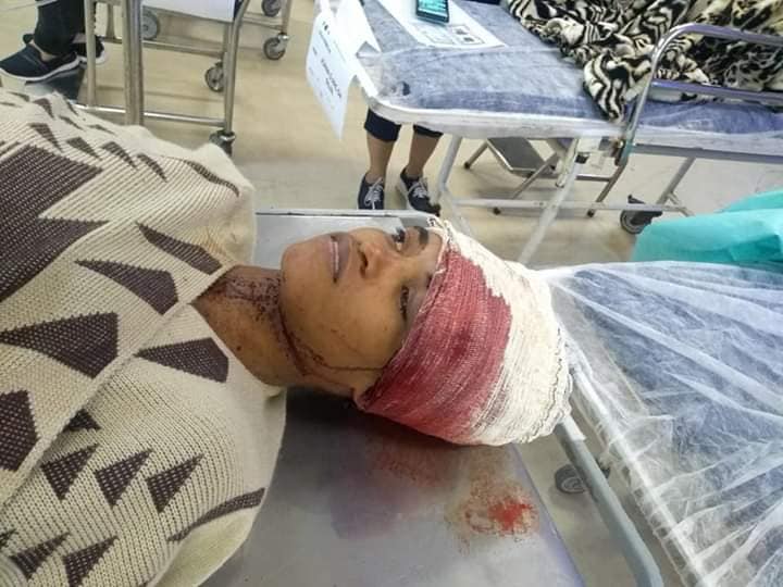 ÔNIBUS ATROPELA JOVEM EM CAMPO GRANDE!! MOTORISTA FUGIU( FOTOS)