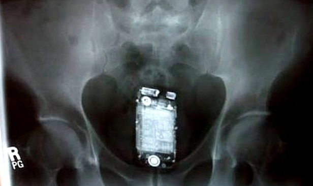 Vistoria na prisão: Enfiou o celular no ânus, mas ele tocou