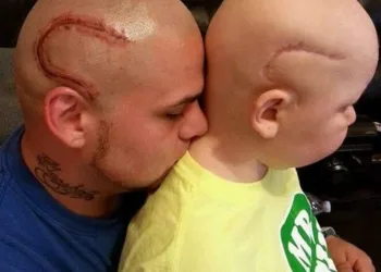 Pai que tatuou cicatriz em apoio ao filho se despede do garoto de 9 anos