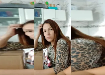 ‘Não falei que ia te matar?’, diz homem que jogou ácido no rosto da ex companheira