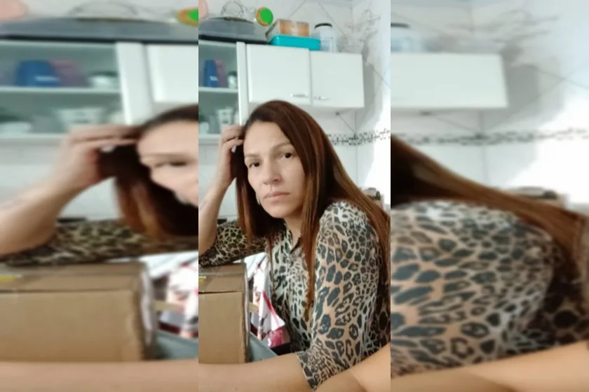 ‘Não falei que ia te matar?’, diz homem que jogou ácido no rosto da ex companheira