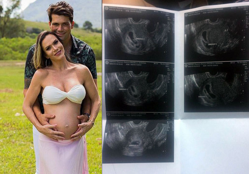 Capixaba descobre que está grávida de quíntuplos