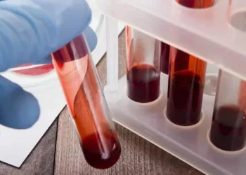 Exame de sangue descobre qualquer tipo de câncer dez anos antes de se manifestar