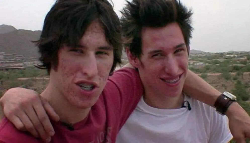 Gêmeos fazem plástica para parecerem Brad Pitt, e resultado impressiona