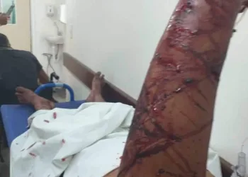 HOMEM QUASE FOI MORTO POR CÃO DA RAÇA PITBULL (FOTO)