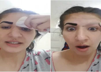 Cuidado com esse produto! garota perde a sobrancelha após usar produto que comprou na internet!