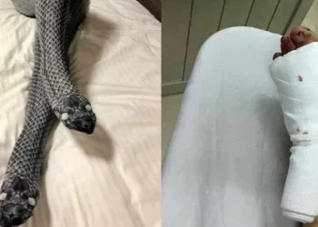 APÓS USAR MEIA-CALÇA DE “COBRA”, MULHER ASSUSTA MARIDO E LEVA PAULADAS