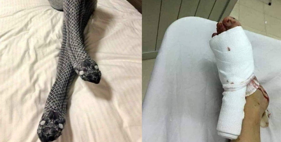 APÓS USAR MEIA-CALÇA DE “COBRA”, MULHER ASSUSTA MARIDO E LEVA PAULADAS