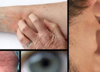 8 sintomas de pré-diabetes que você não conhece e jamais deve ignorar