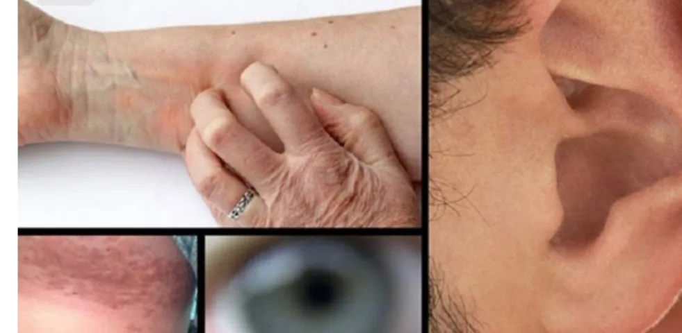 8 sintomas de pré-diabetes que você não conhece e jamais deve ignorar