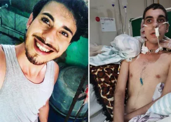 Homofobia: jovem é brutalmente agredido e pessoas se mobilizam para ajudá-lo