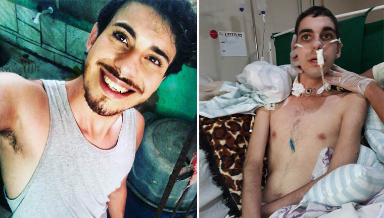 Homofobia: jovem é brutalmente agredido e pessoas se mobilizam para ajudá-lo