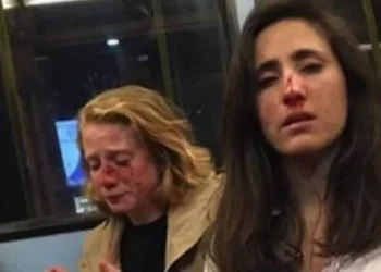 Casal de namoradas é agredido após homens exigirem que elas se beijassem: ‘Como se fôssemos um espetáculo’