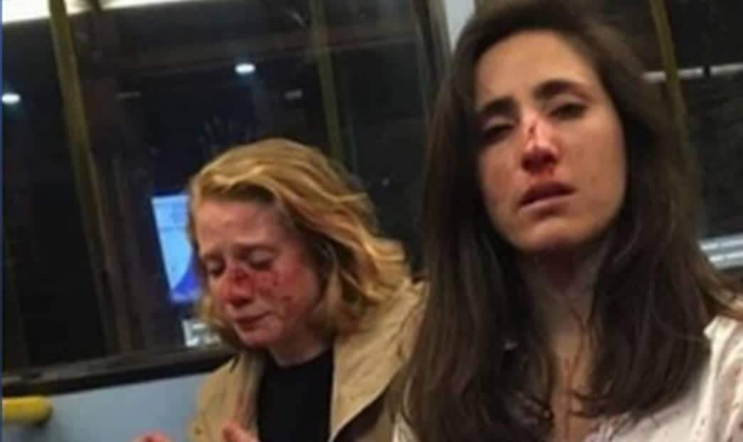 Casal de namoradas é agredido após homens exigirem que elas se beijassem: ‘Como se fôssemos um espetáculo’