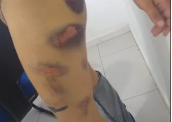 Homem é preso por torturar e fazer ex-namorada comer fezes