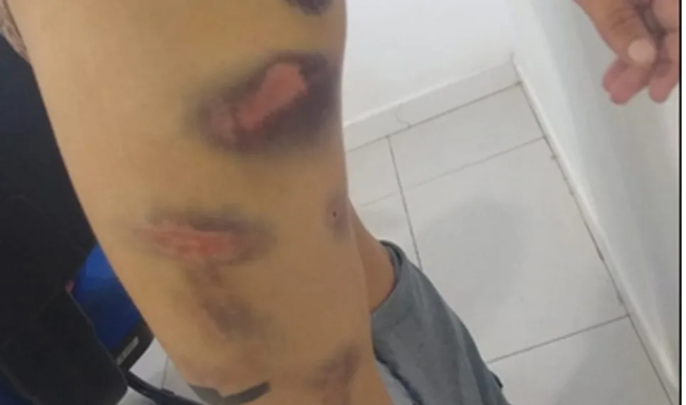 Homem é preso por torturar e fazer ex-namorada comer fezes