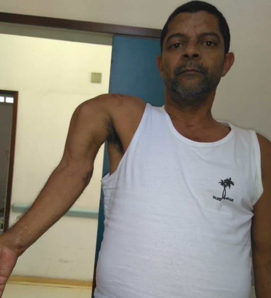 Homem com braço quebrado espera há um ano por cirurgia no Rio