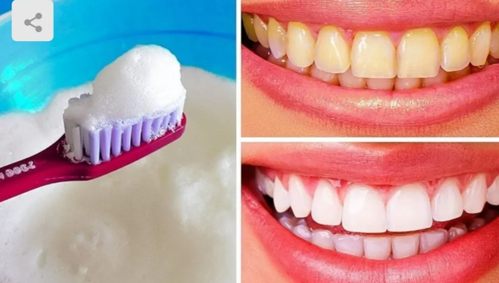 Aprenda 6 maneiras naturais de clarear os dentes e que realmente funcionam