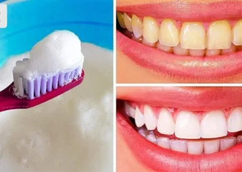 Aprenda 6 maneiras naturais de clarear os dentes e que realmente funcionam