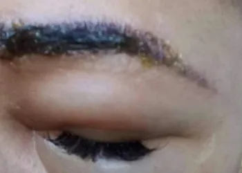 ALERTA A TODAS AS MULHERES!! CÍLIOS,  SOBRANCELHAS (FOTOS)