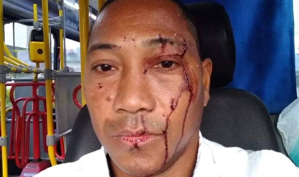 MOTORISTA DE ÔNIBUS É AGREDIDO POR MOTORISTA DE VAN NA ZONA OESTE