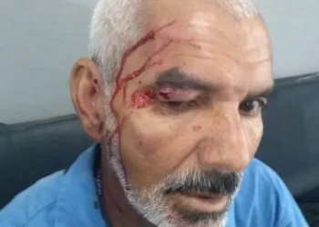 FUNCIONÁRIO DA CEDAE É AGREDIDO APÓS ENTREGAR CONTA DE ÁGUA