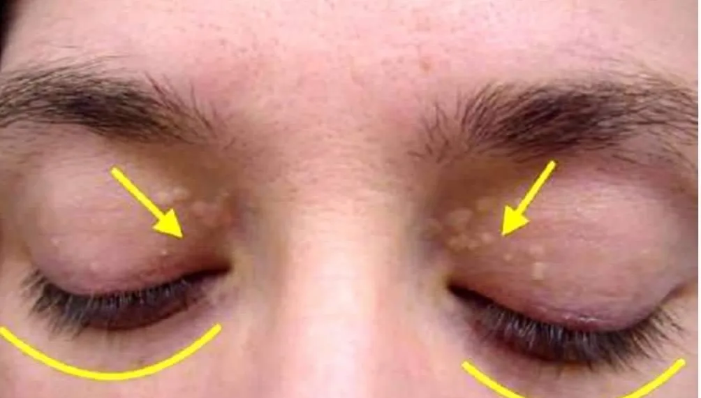 Se isto aparecer nos seus olhos tenha atenção; o motivo é assustador e pode ser fatal