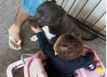 Bebê de um ano morre após ser atacado por Pit Bull dentro de casa