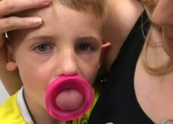 Menino de 6 anos passa por cirurgia arriscada após ficar com língua presa em garrafa