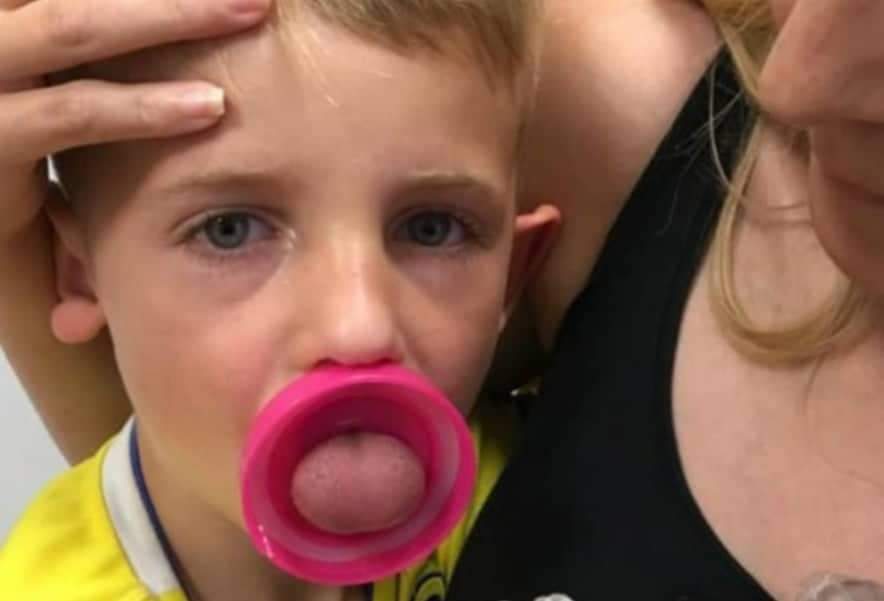 Menino de 6 anos passa por cirurgia arriscada após ficar com língua presa em garrafa