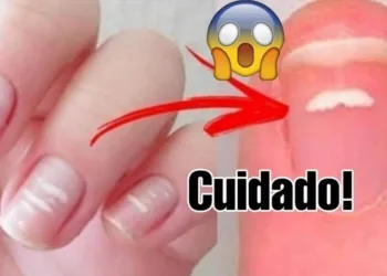 CUIDADO! Você tem essas MANCHAS nas unhas? É melhor ir ao médico